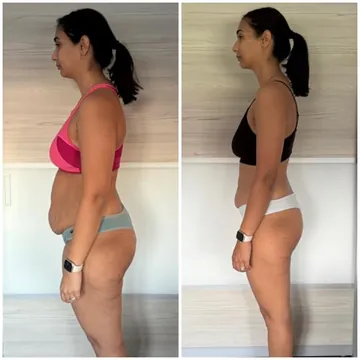 Kym’s before and after: lost 25 kg